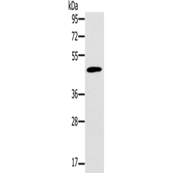 兔抗KCNJ15多克隆抗体