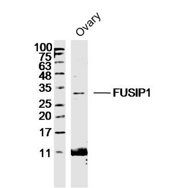 Anti-FUSIP1 antibody