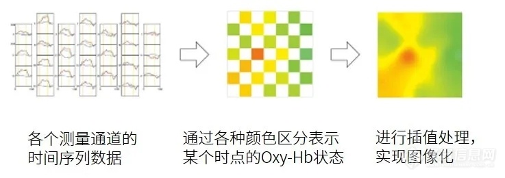 岛津与全球科学家一起行动丨脑功能成像探索生命领域的奥秘