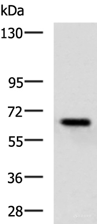 兔抗KBTBD8多克隆抗体.jpg
