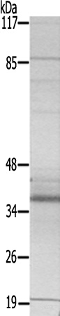 兔抗JUN(Ab-63) 多克隆抗体 .jpg