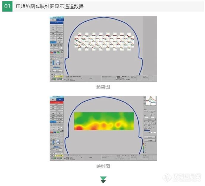 岛津与全球科学家一起行动丨脑功能成像探索生命领域的奥秘