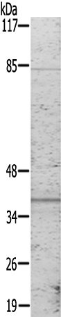 兔抗JUN(Ab-243) 多克隆抗体.jpg