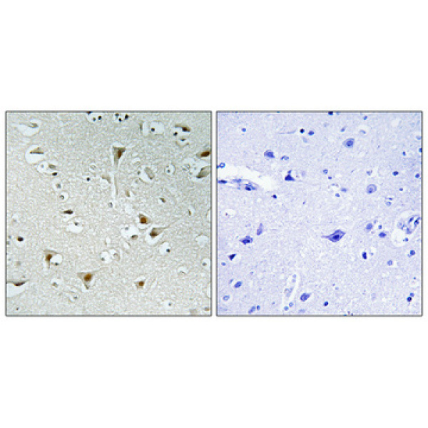 Anti-FAM111B antibody