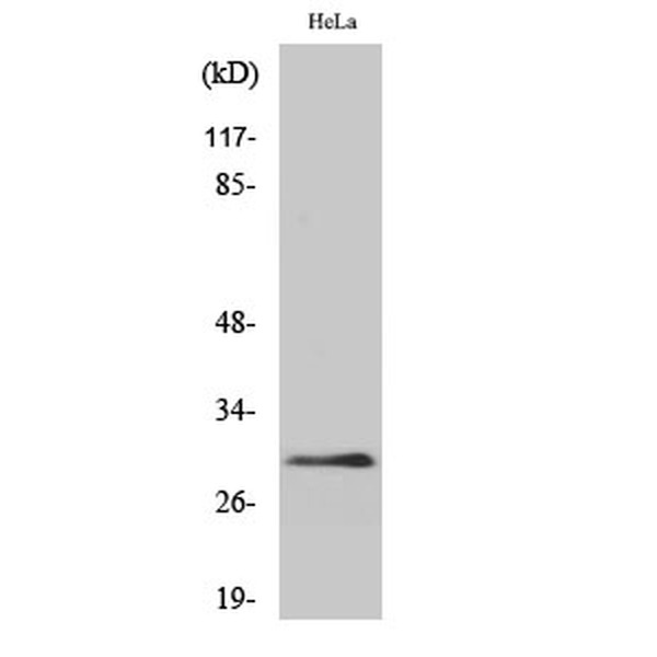 Anti-eIF3K antibody