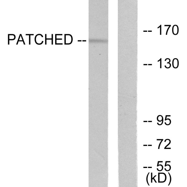 Anti-Patched antibody