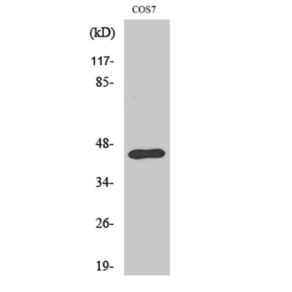 Anti-Ephrin-B1 antibody