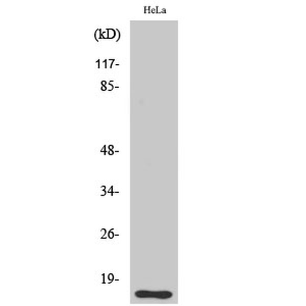 Anti-DOC-1 antibody