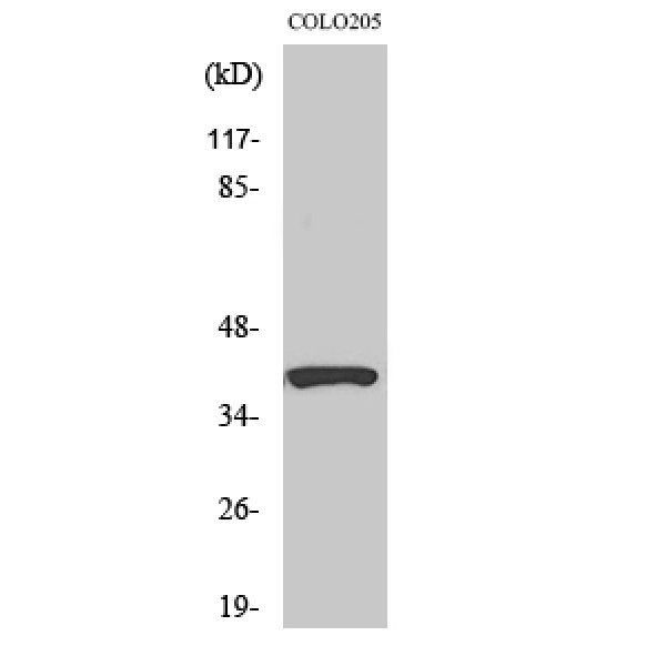 Anti-PI-9 antibody