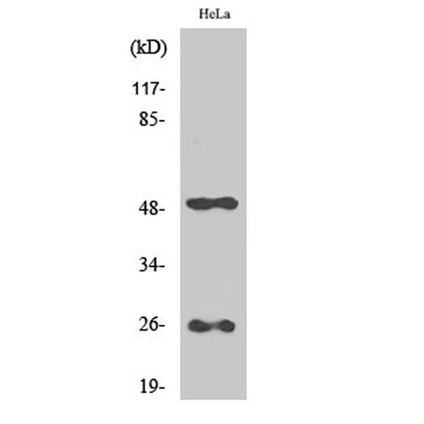 Anti-Clusterin antibody