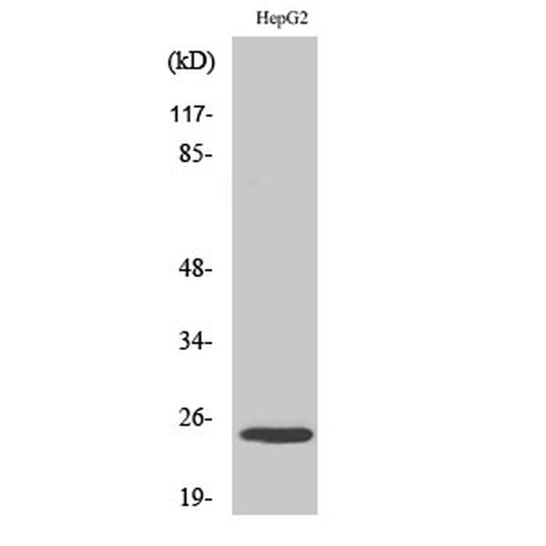 Anti-MaxiKβ antibody