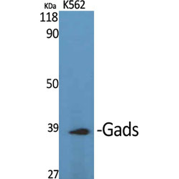 Anti-GAK antibody