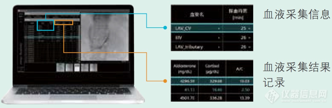 岛津与全球科学家一起行动丨原发性醛固酮增多症研究