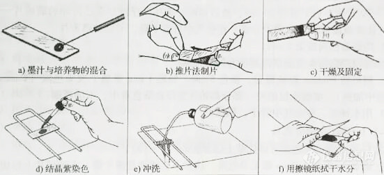 常见细菌染色方法汇总！4.jpg