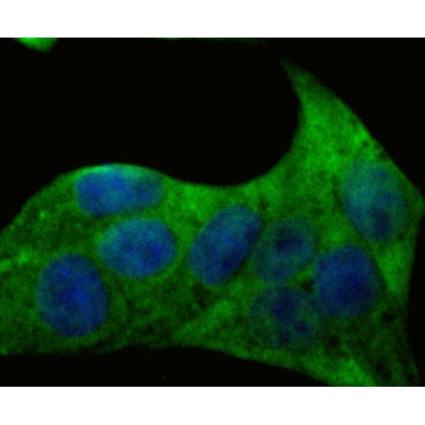 Anti-Desmoglein 3 antibody