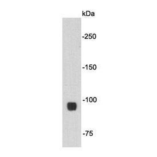 Anti-APOER2 antibody