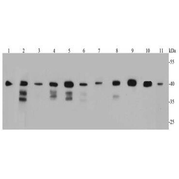 Anti-Bmi1 antibody