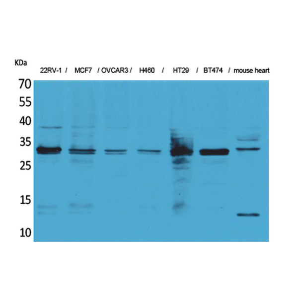 Anti-Latexin antibody