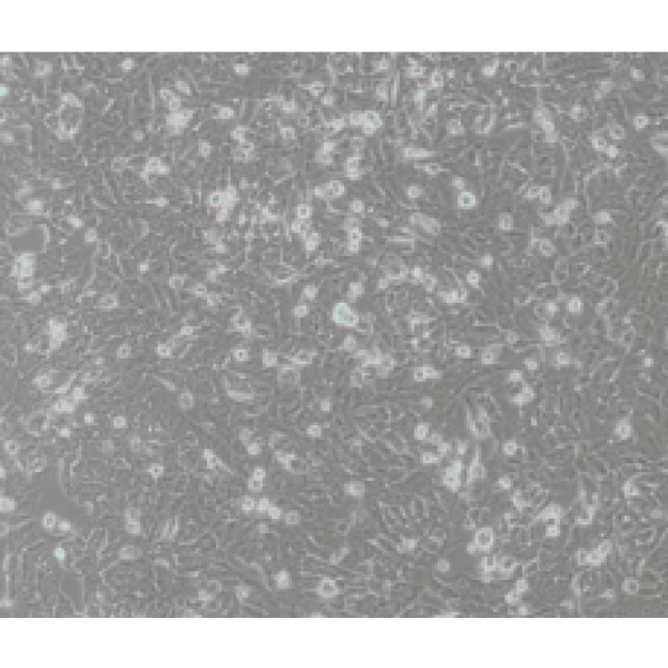JEG-3人绒毛膜癌细胞