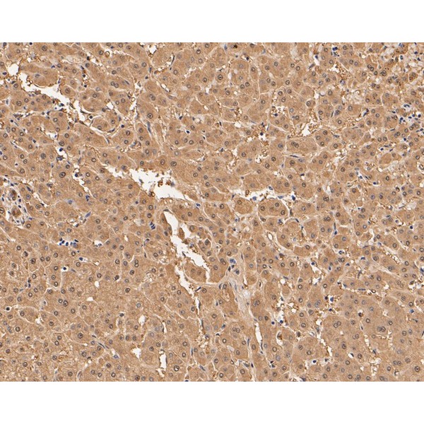 Anti-Aspartate Aminotransferase antibody