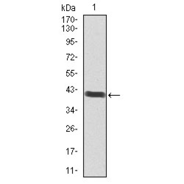 Anti-POU3F2 antibody