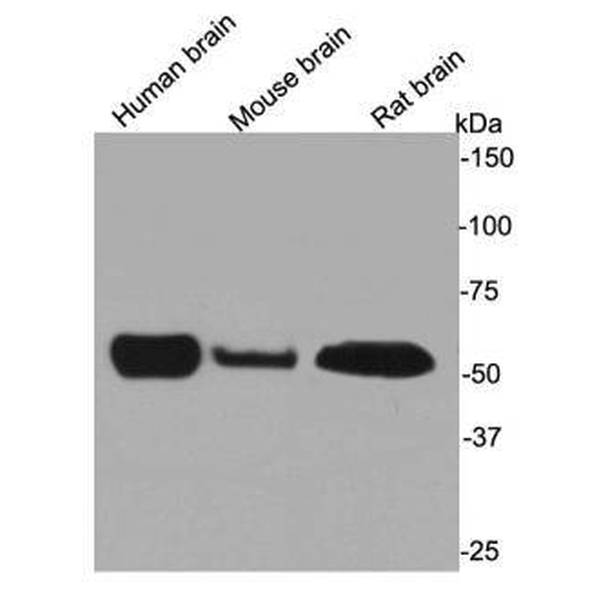 Anti-Beta III Tubulin antibody