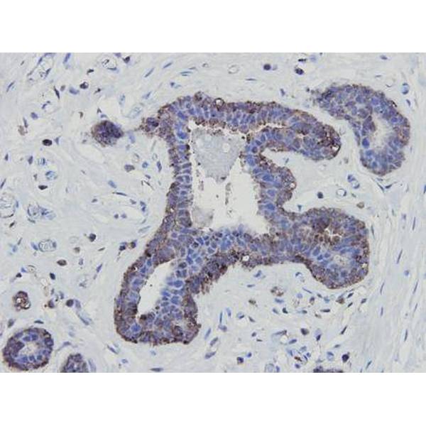 Anti-eNOS antibody