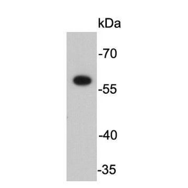 Anti-Restriction enzyme FokI(C-term) antibody