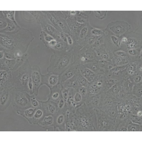 Granta-519人套细胞淋巴瘤细胞