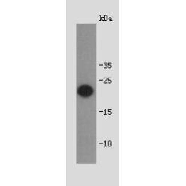 Anti-Shiga toxin subunit B antibody