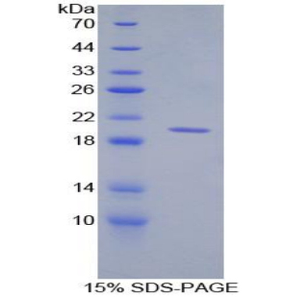 CD30L重组蛋白；CD30配体重组蛋白