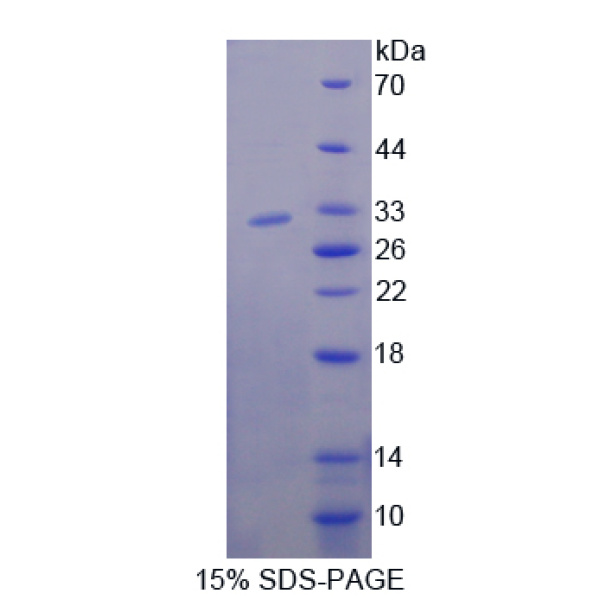 NUP85重组蛋白；85kDa核孔蛋白重组蛋白