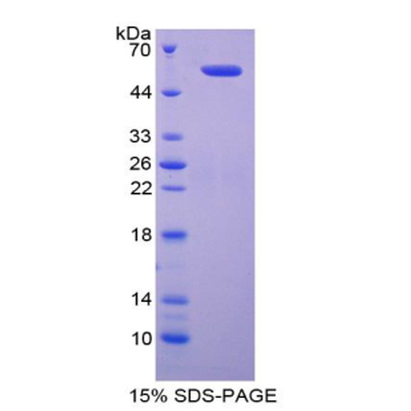 DIAPH1重组蛋白；Diaphanous同源物1重组蛋白