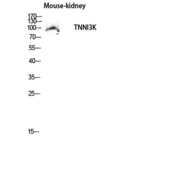 Anti-TNNI3K antibody