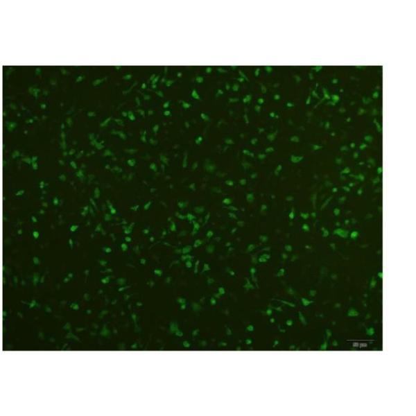 GC9811-P人胃癌腹膜高转移细胞