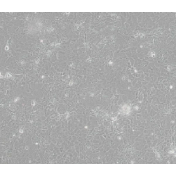 TNC-1B12B4小鼠抗人TNC单抗细胞
