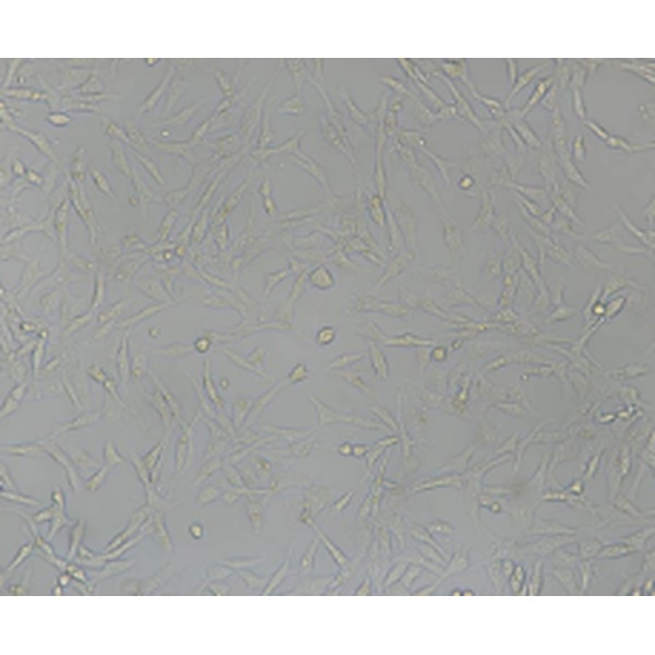 TSU-Pr1人前列腺癌细胞