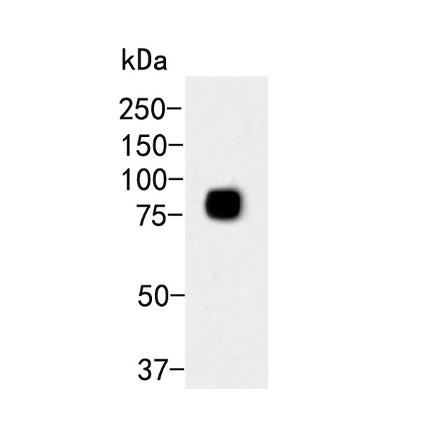 Anti-Transferrin antibody