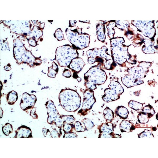 Anti-GH antibody