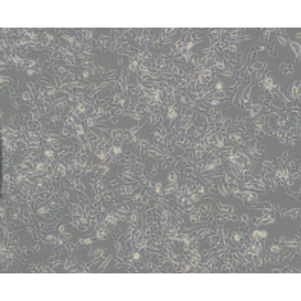 CCRF-CEM [CCRF CEM]人急性T淋巴细胞白血病细胞