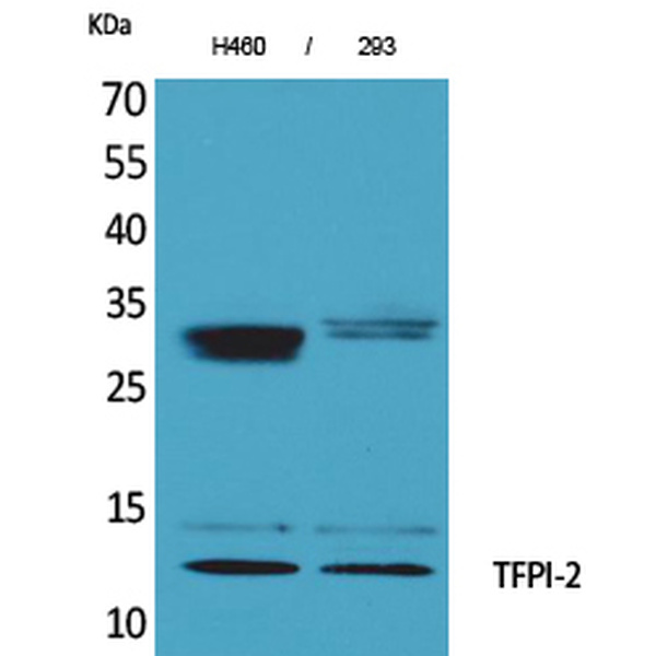 Anti-TFPI-2 antibody