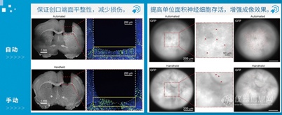 瑞沃德发布RWD71000全自动脑立体定位仪-大小鼠新品