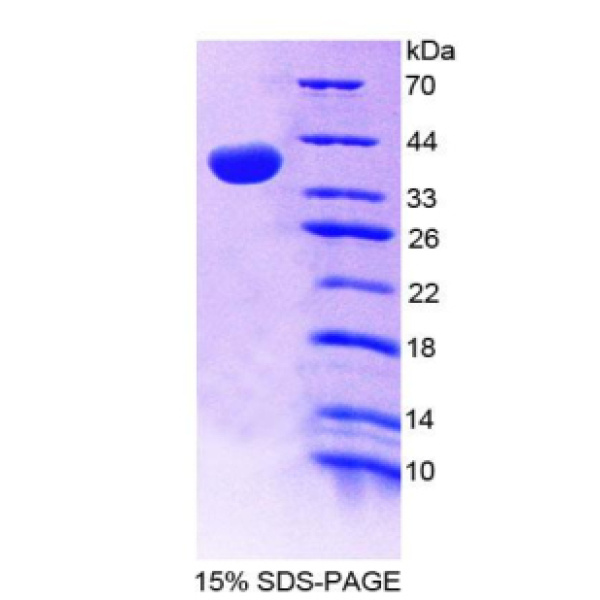 VLDLR重组蛋白；极低密度脂蛋白受体重组蛋白