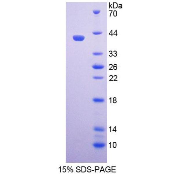 溶质载体家族30成员1(SLC30A1)重组蛋白