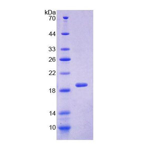 核RNA输出因子1(NXF1)重组蛋白