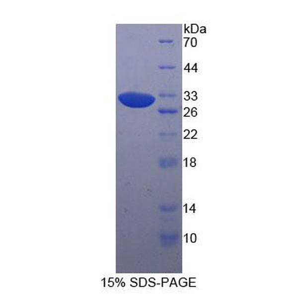 含卷曲螺旋域蛋白80(CCDC80)重组蛋白