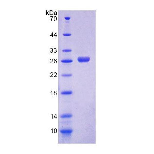 真核翻译延伸因子1δ(EEF1d)重组蛋白