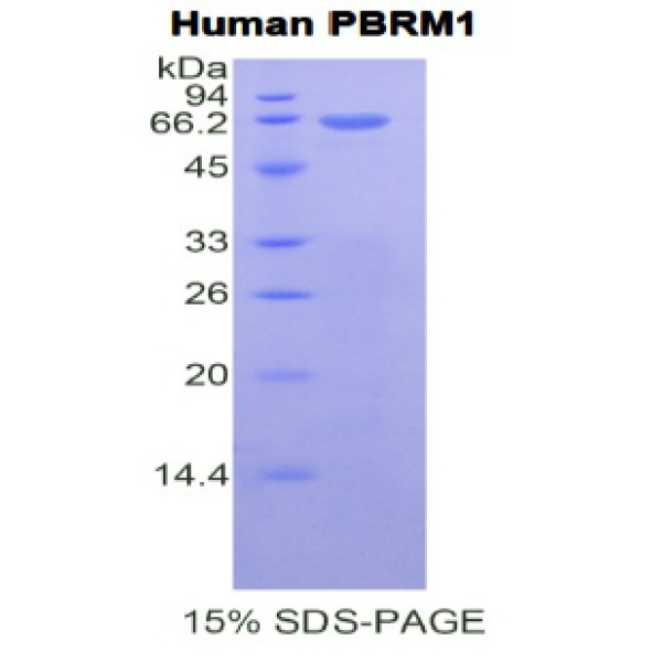 细胞程序性死亡蛋白1配体2(PDL2)重组蛋白