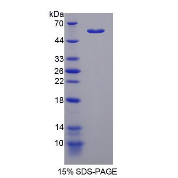 细胞死亡诱导DFFA样效应蛋白C(CIDEC)重组蛋白