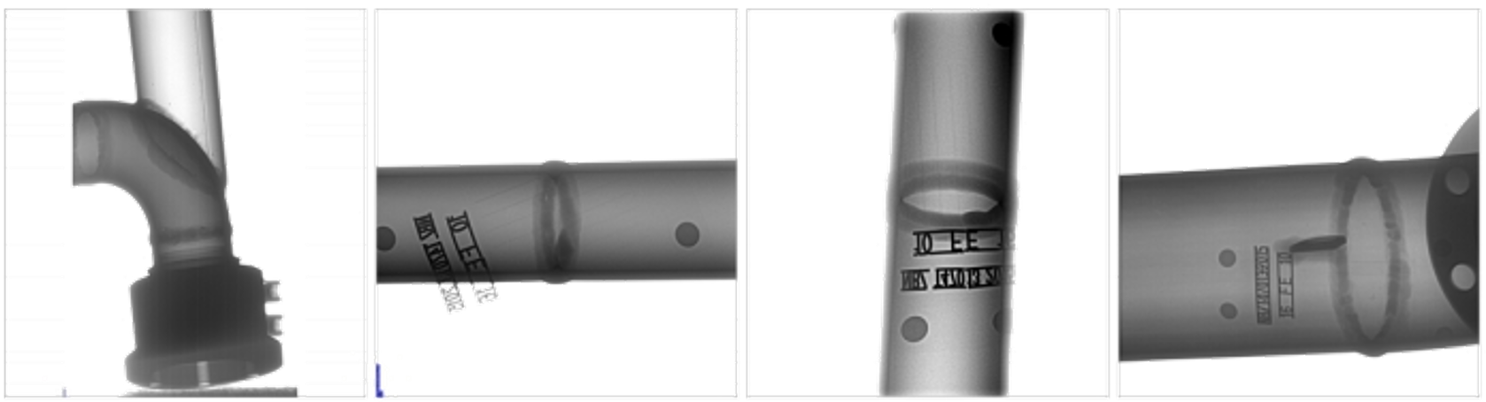 变频便携式X射线DR成像系统(AL-DR-300C)